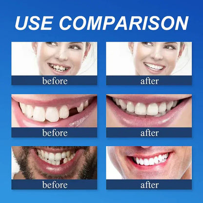 Ends Today: 49% OFF! ⏰ KLENIMORE™ Custom-Fit Smile Support Set — Strong Hold & Natural Look 🦷