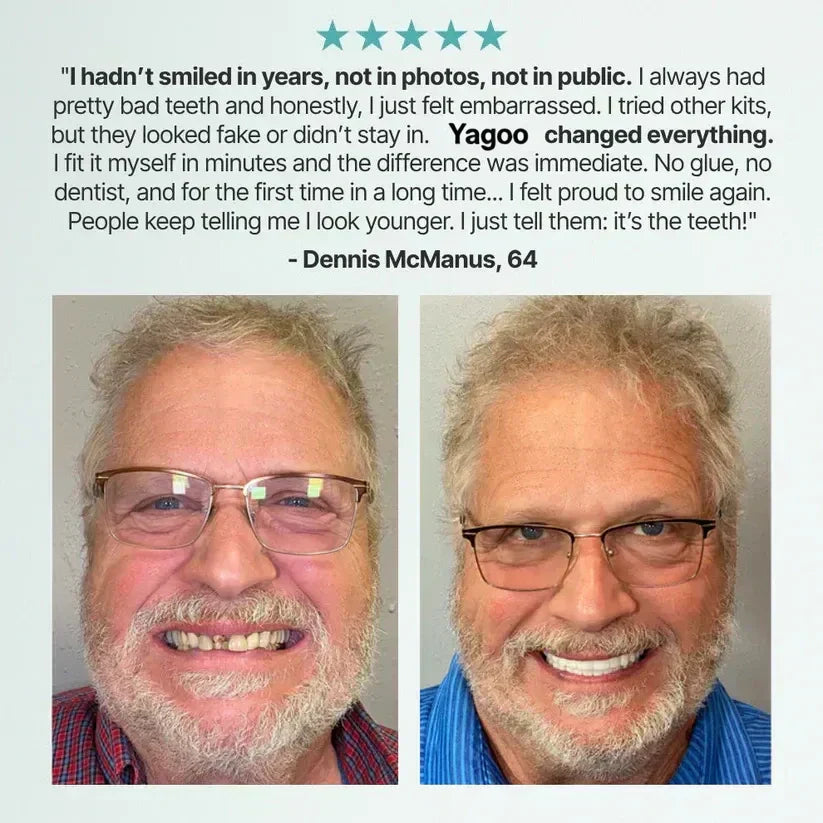 🏆Ends Today: 50% OFF! 🏆2026 Bestselling Product🦷 Fit for a Fresh Smile, Say Goodbye to Wearing Discomfort!🌎