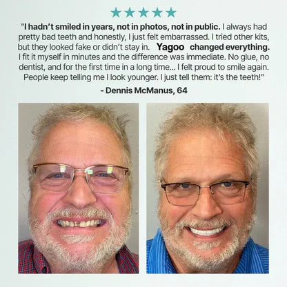 🏆Ends Today: 50% OFF! 🏆2026 Bestselling Product🦷 Fit for a Fresh Smile, Say Goodbye to Wearing Discomfort!🌎