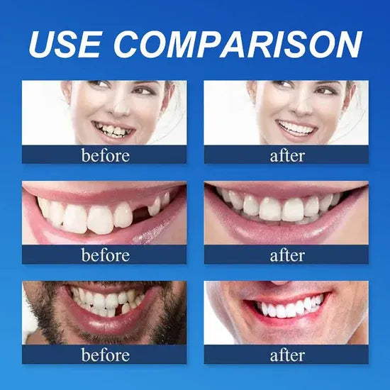 🏆Ends Today: 50% OFF! 🏆2026 Bestselling Product🦷 Fit for a Fresh Smile, Say Goodbye to Wearing Discomfort!🌎