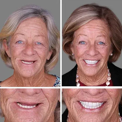 🏆Ends Today: 50% OFF! 🏆2026 Bestselling Product🦷 Fit for a Fresh Smile, Say Goodbye to Wearing Discomfort!🌎